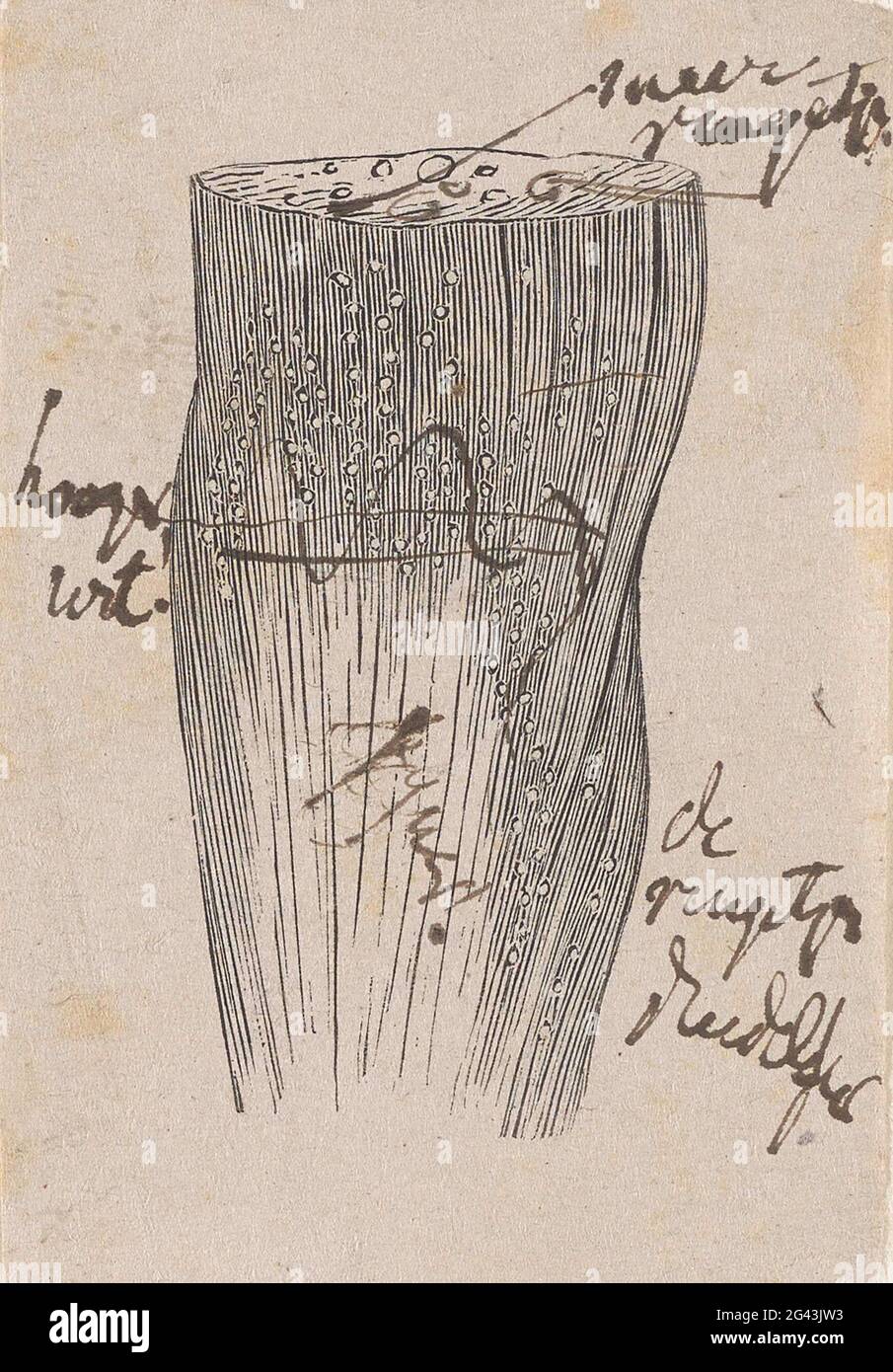 Part of the human body with a deviation Stock Photo - Alamy