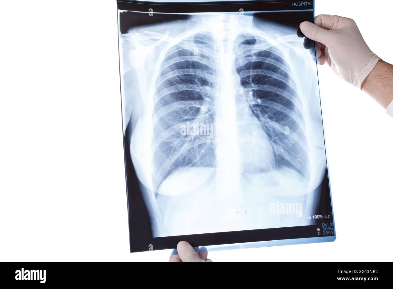 Doctor looking at chest x-ray Stock Photo