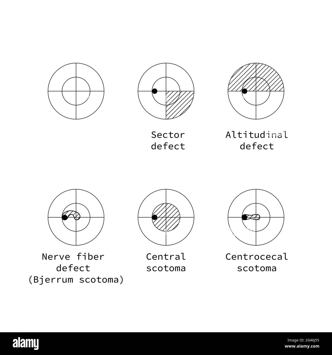 https://c8.alamy.com/comp/2G46J55/amsler-test-grid-eye-scotoma-chart-oculist-vector-printable-chart-retina-examination-grid-with-dot-in-centre-vision-control-2G46J55.jpg