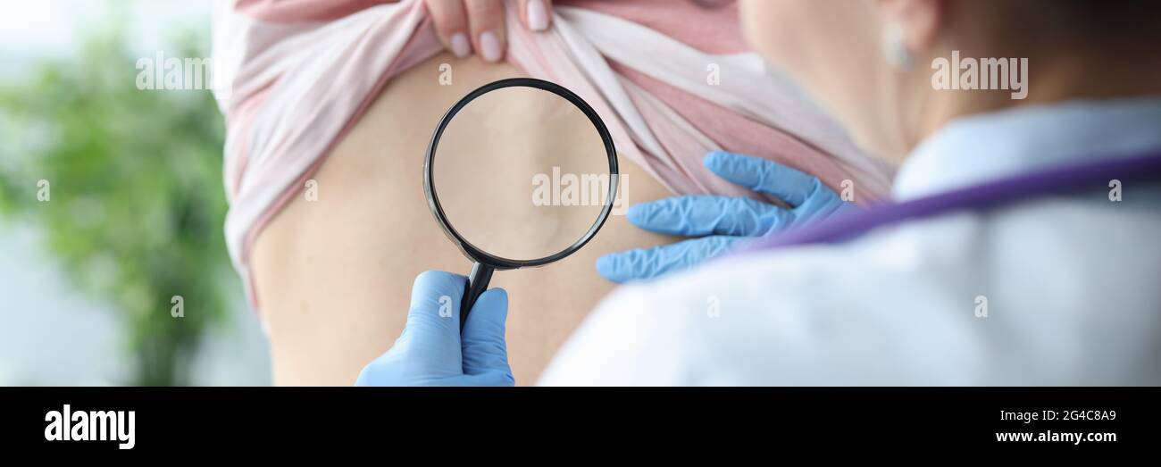 Doctor examining skin on back of female patient using magnifying glass Stock Photo