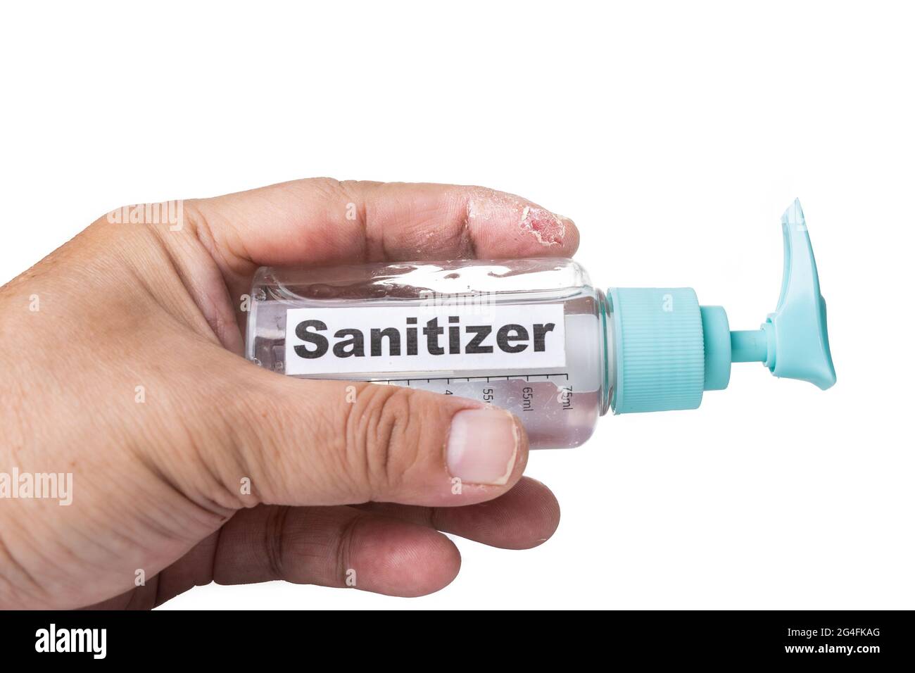 Dry skin finger with bottle of hand sanitizer. Sanitizer causes dryness