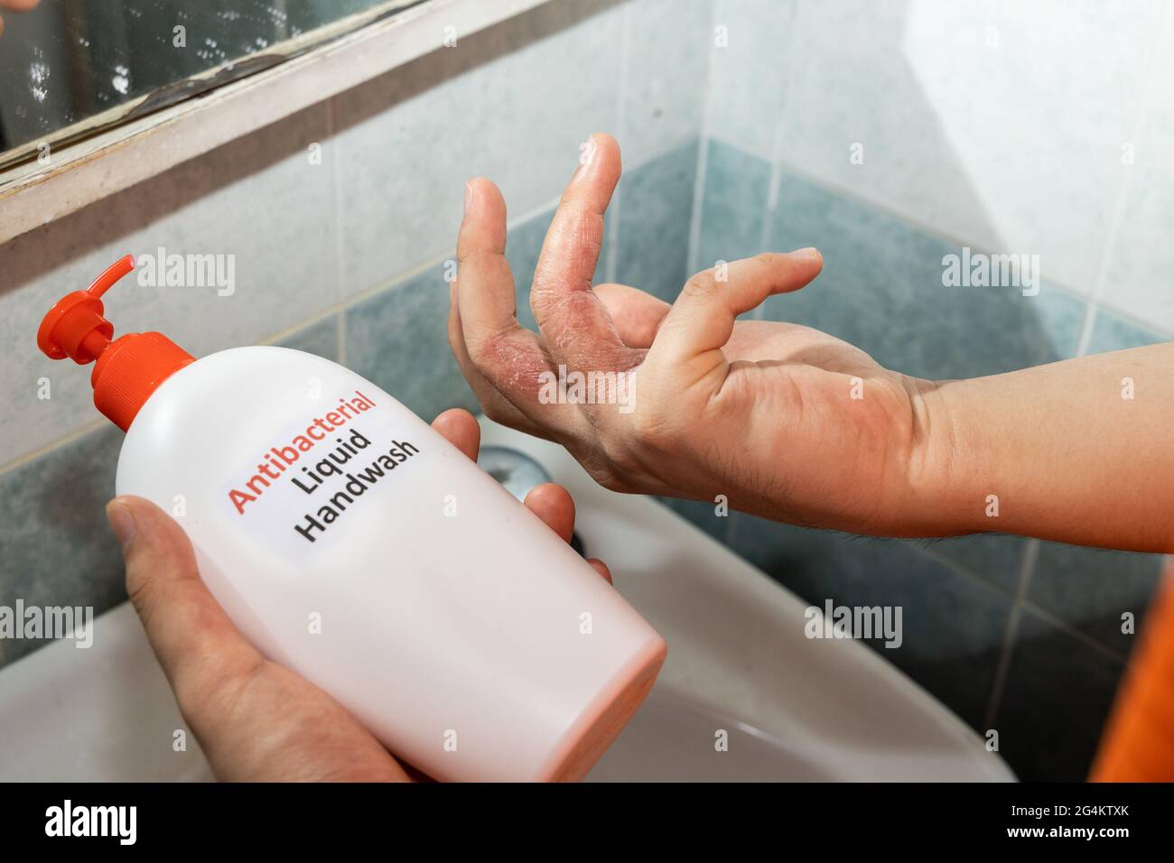 Dry skin on finger with bottle of antibacterial liquid handwash