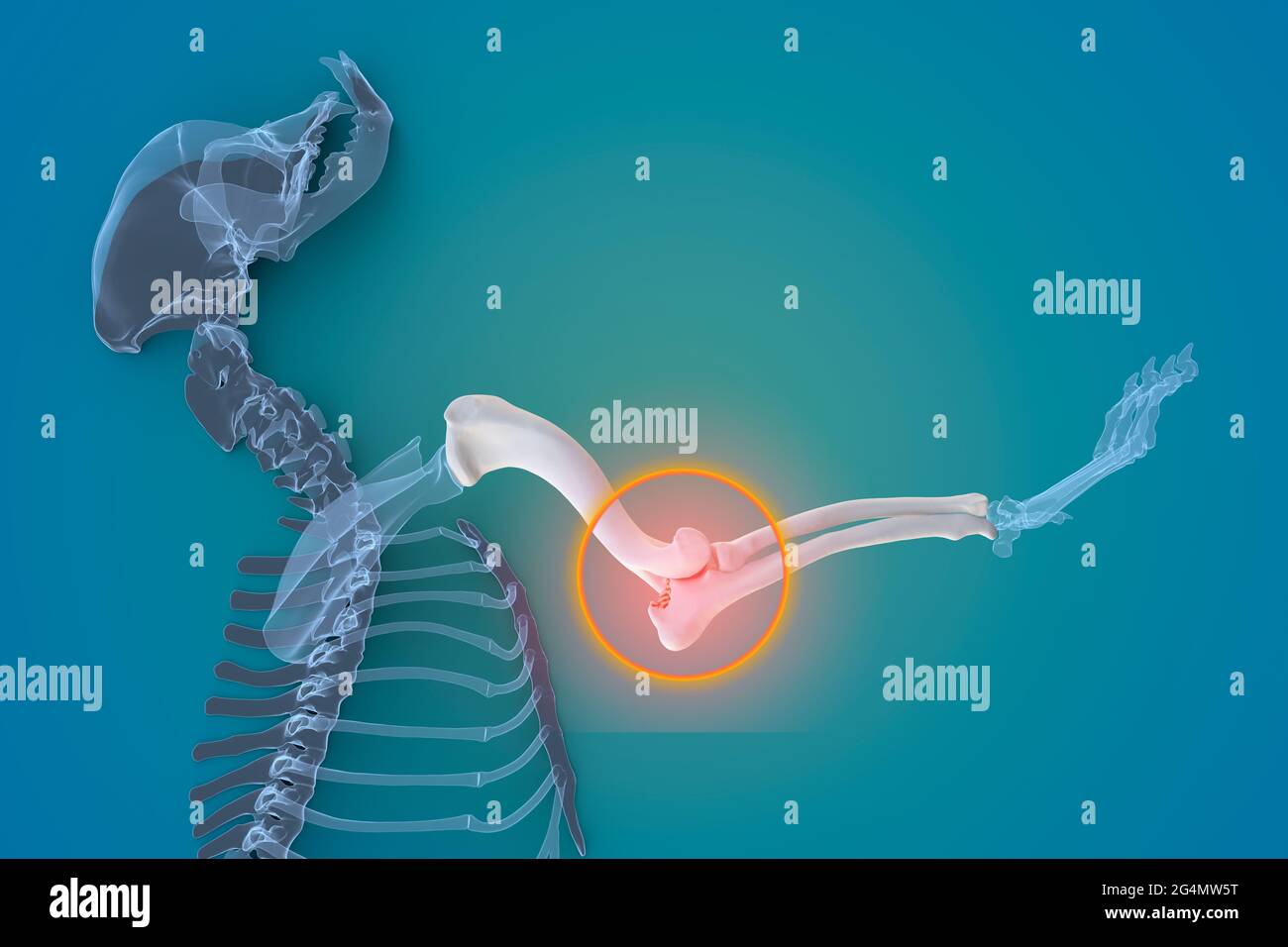Canine Arthritis and Osteoarthritis joint inflammation, deterioration