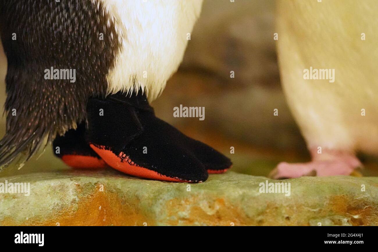 Arthritis feet hires stock photography and images Alamy