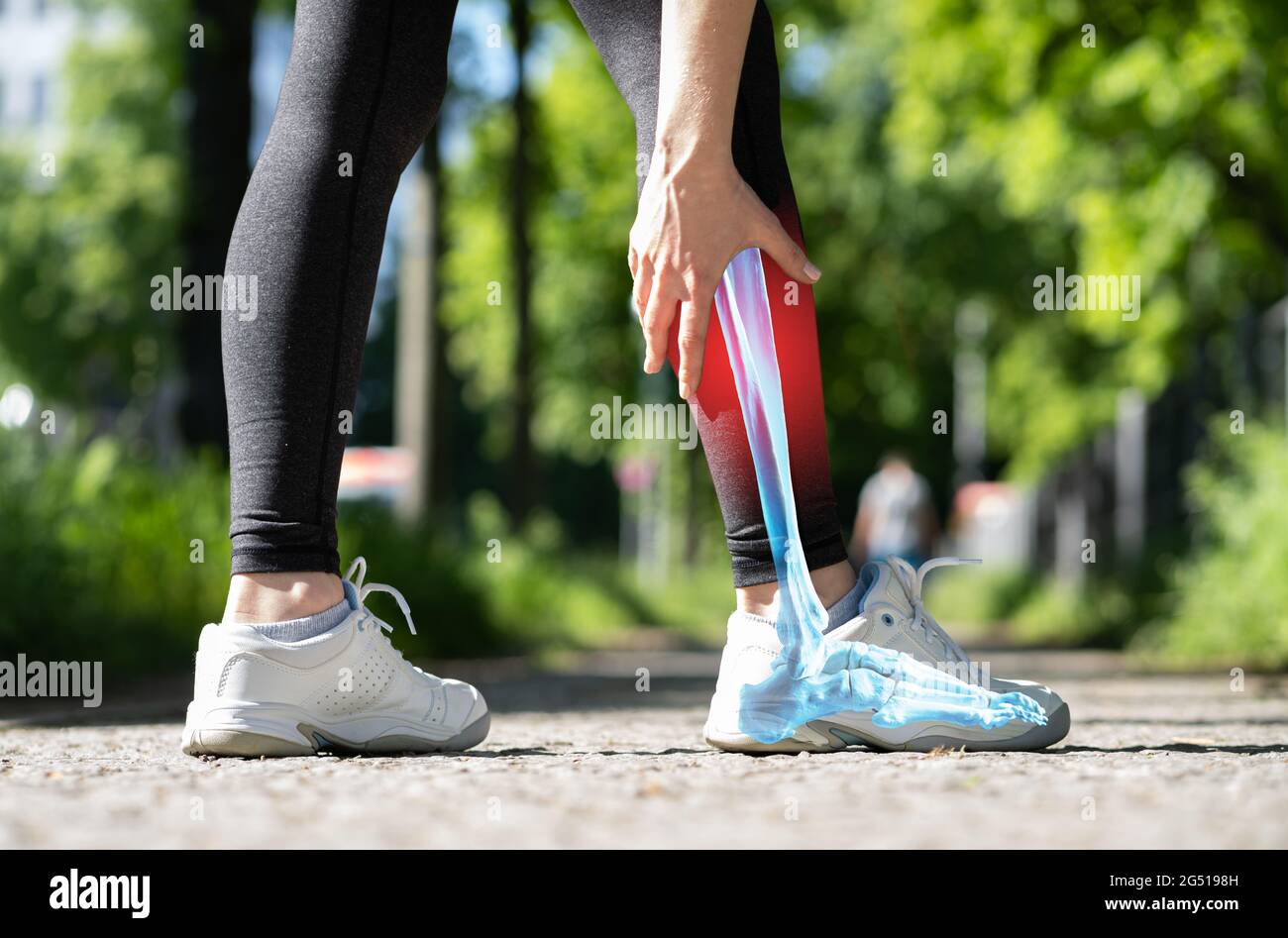 Calf cramp hires stock photography and images Alamy