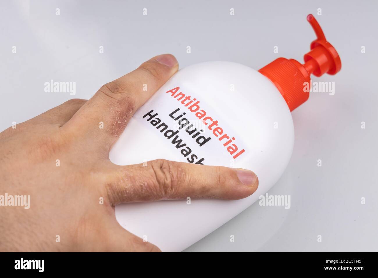 Dry skin on finger with bottle of antibacterial liquid handwash