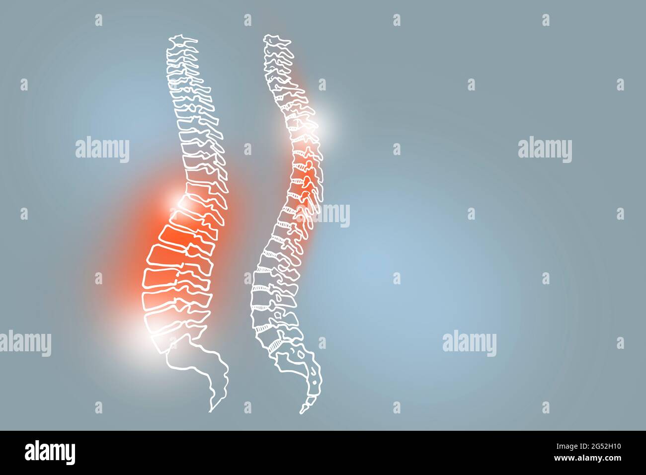 Handrawn illustration of human Spine on light grey background. Medical, science set with main human organs with empty copy space for text Stock Photo
