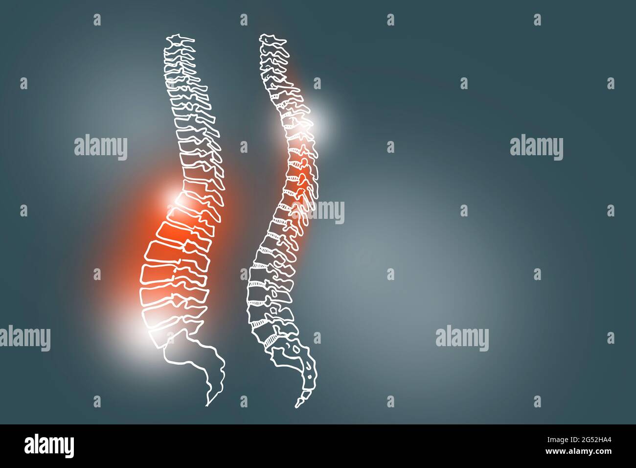 Handrawn illustration of human Spine on dark grey background. Medical, science set with main human organs with empty copy space for text Stock Photo