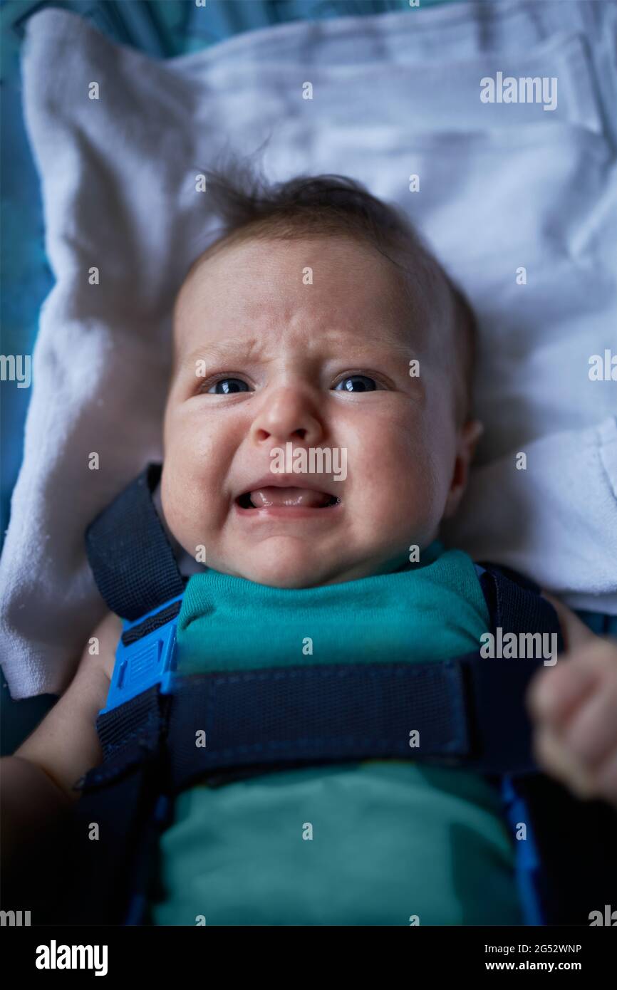 Baby skin rash hires stock photography and images Alamy