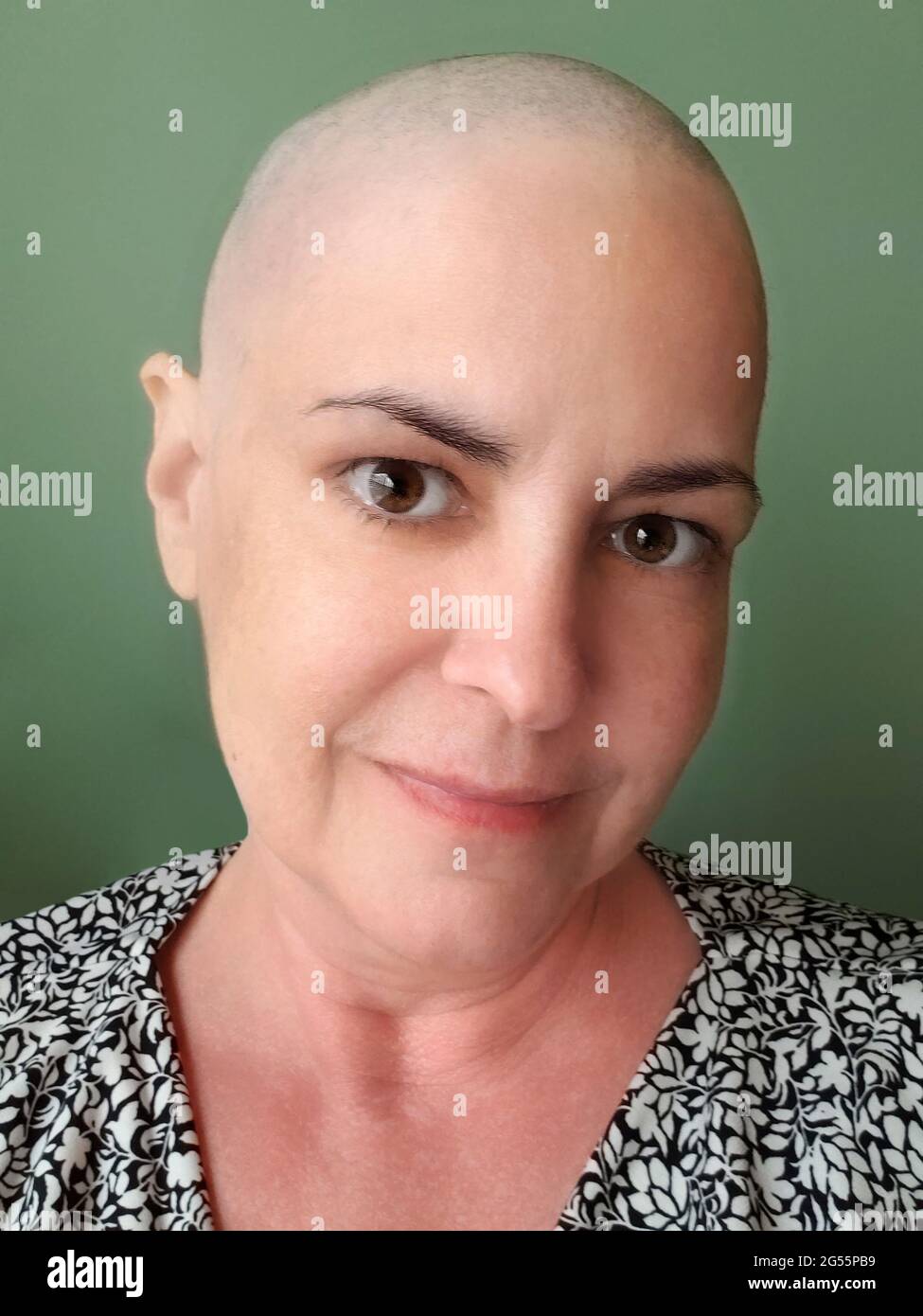 Woman recovering from cancer hires stock photography and images Alamy