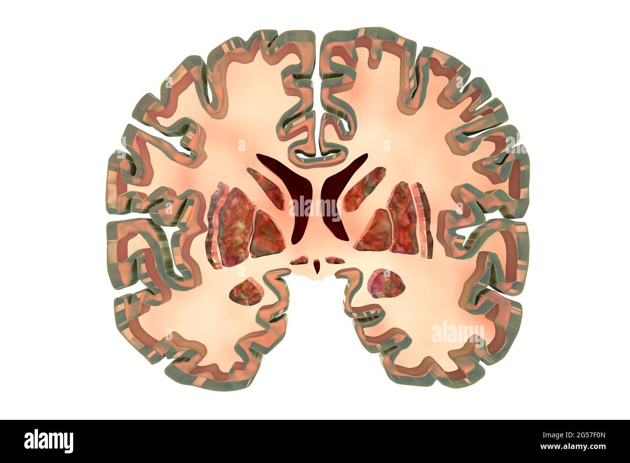 Coronal sections of a healthy brain, illustration Stock Photo