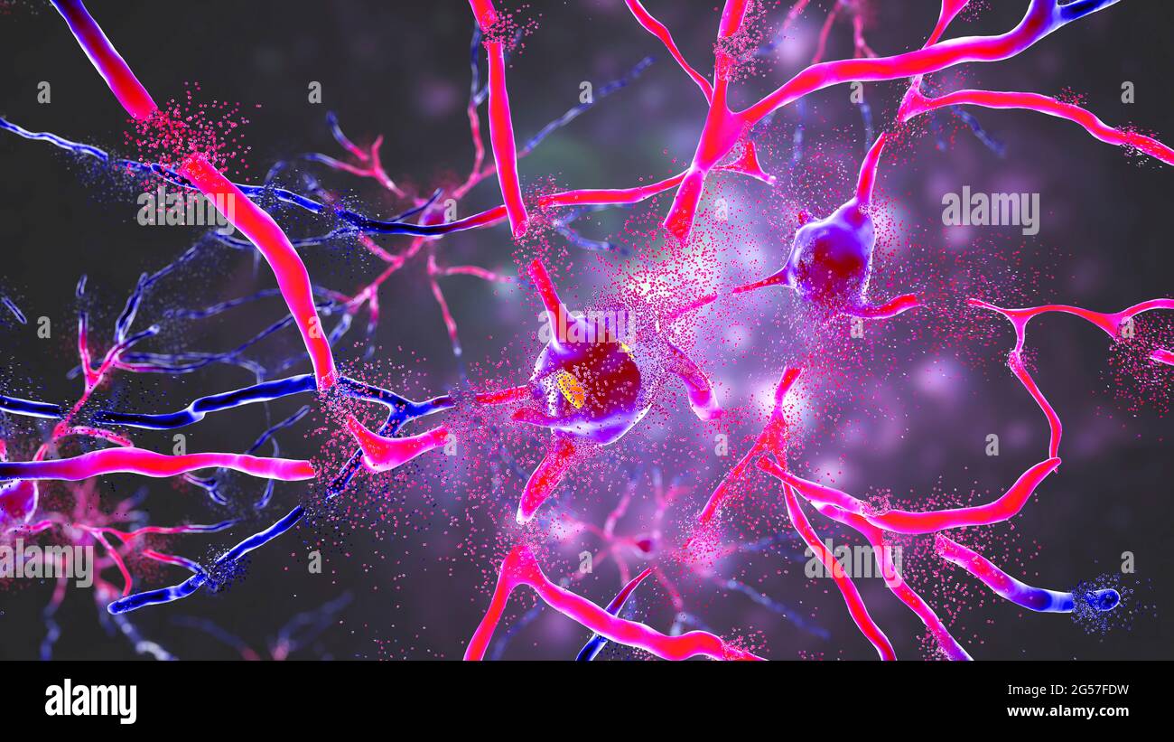 Destruction of neurons in dorsal striatum, illustration Stock Photo