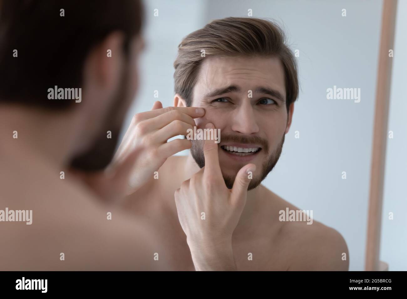 Frustrated handsome millennial guy concerned about facial skin problem Stock Photo