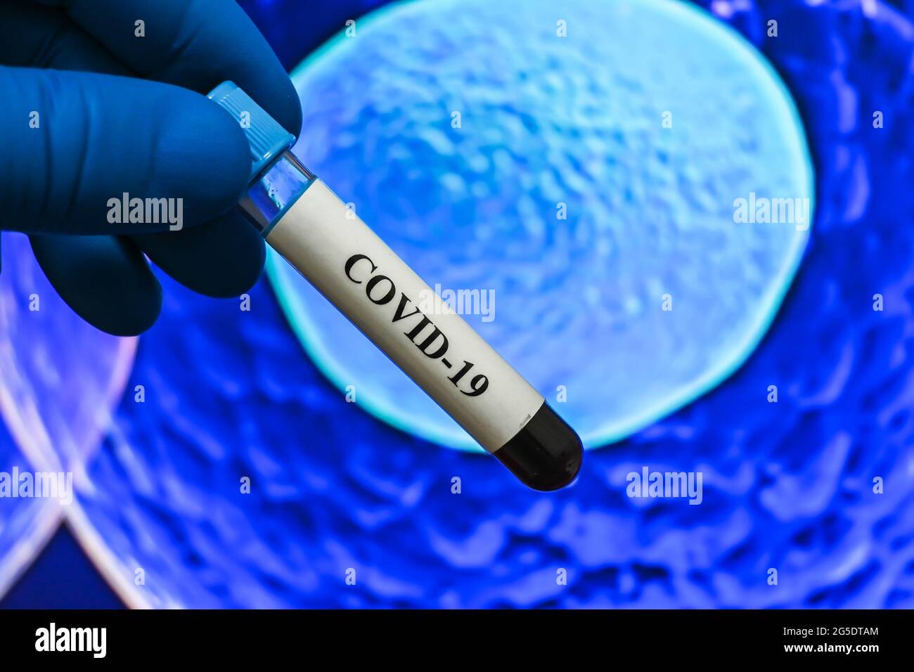 Coronavirus research. Laboratory study of the virus - the causative agent of COVID-19. Stock Photo