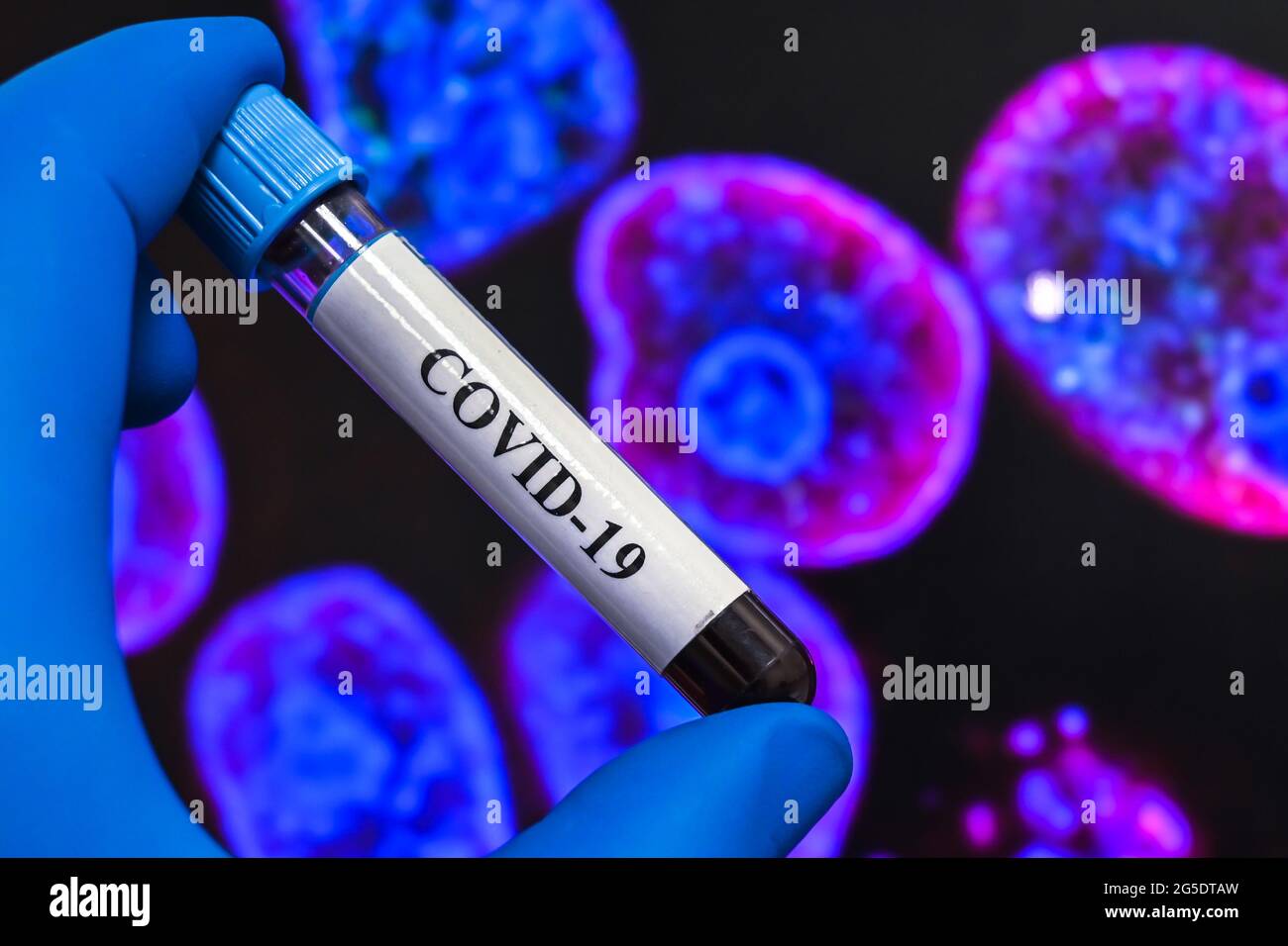 Coronavirus research. Laboratory study of the virus - the causative agent of COVID-19. Stock Photo