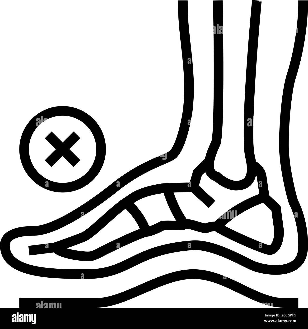 bone postural deformity feet line icon vector illustration Stock Vector