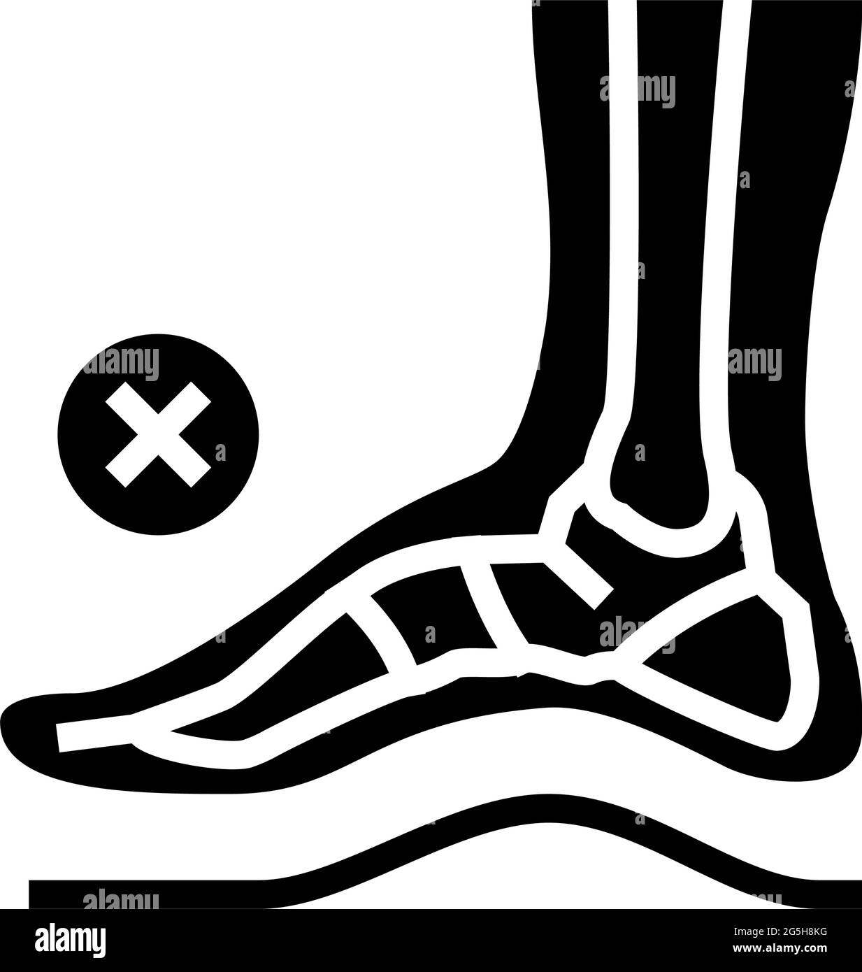bone postural deformity feet glyph icon vector illustration Stock