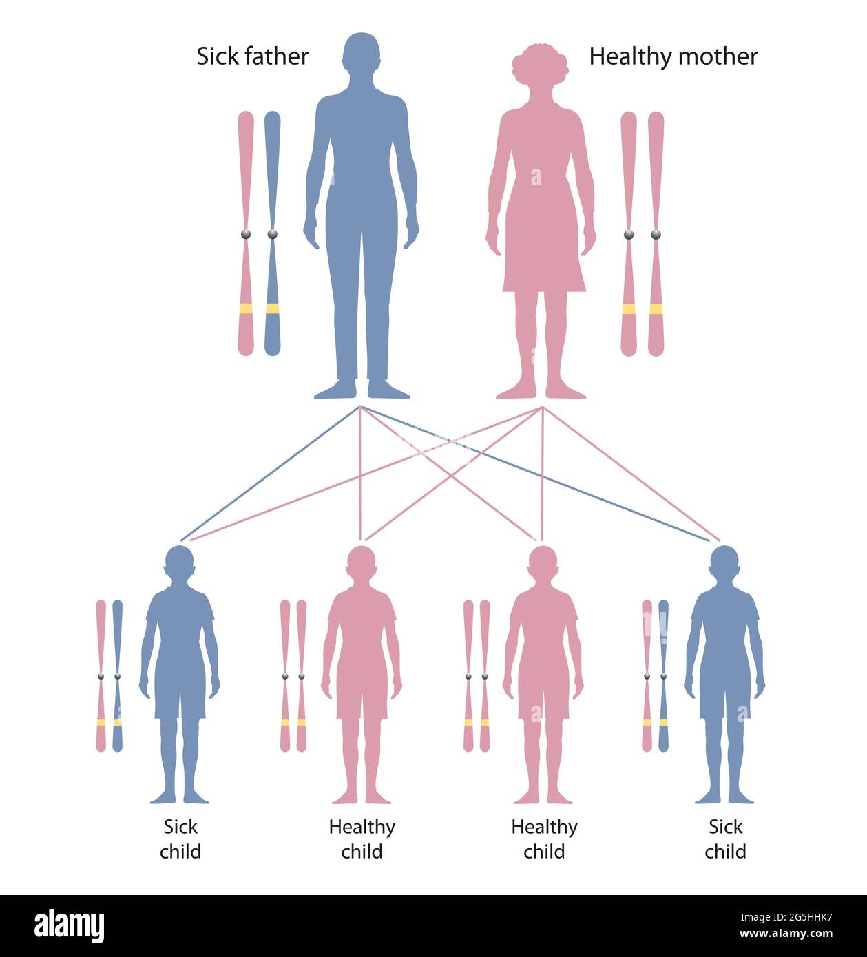 Cystic fibrosis is a genetic disorder. Neurofibromatosis. Heredity Stock Photo