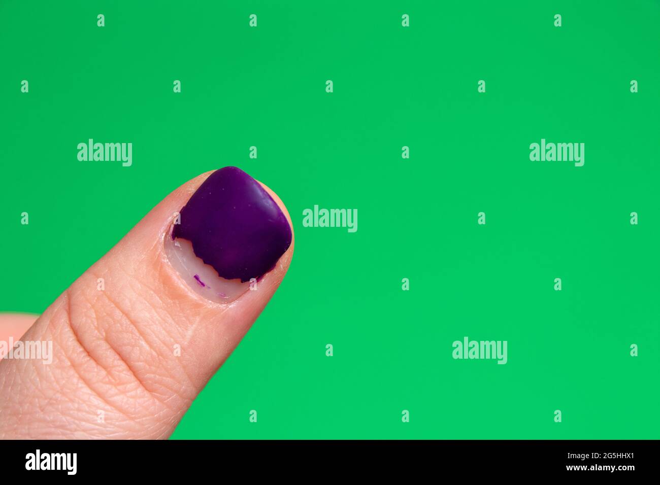 The nail of the thumb with the damaged nail polish is purple. Green background with space for text. Selective focus. Stock Photo