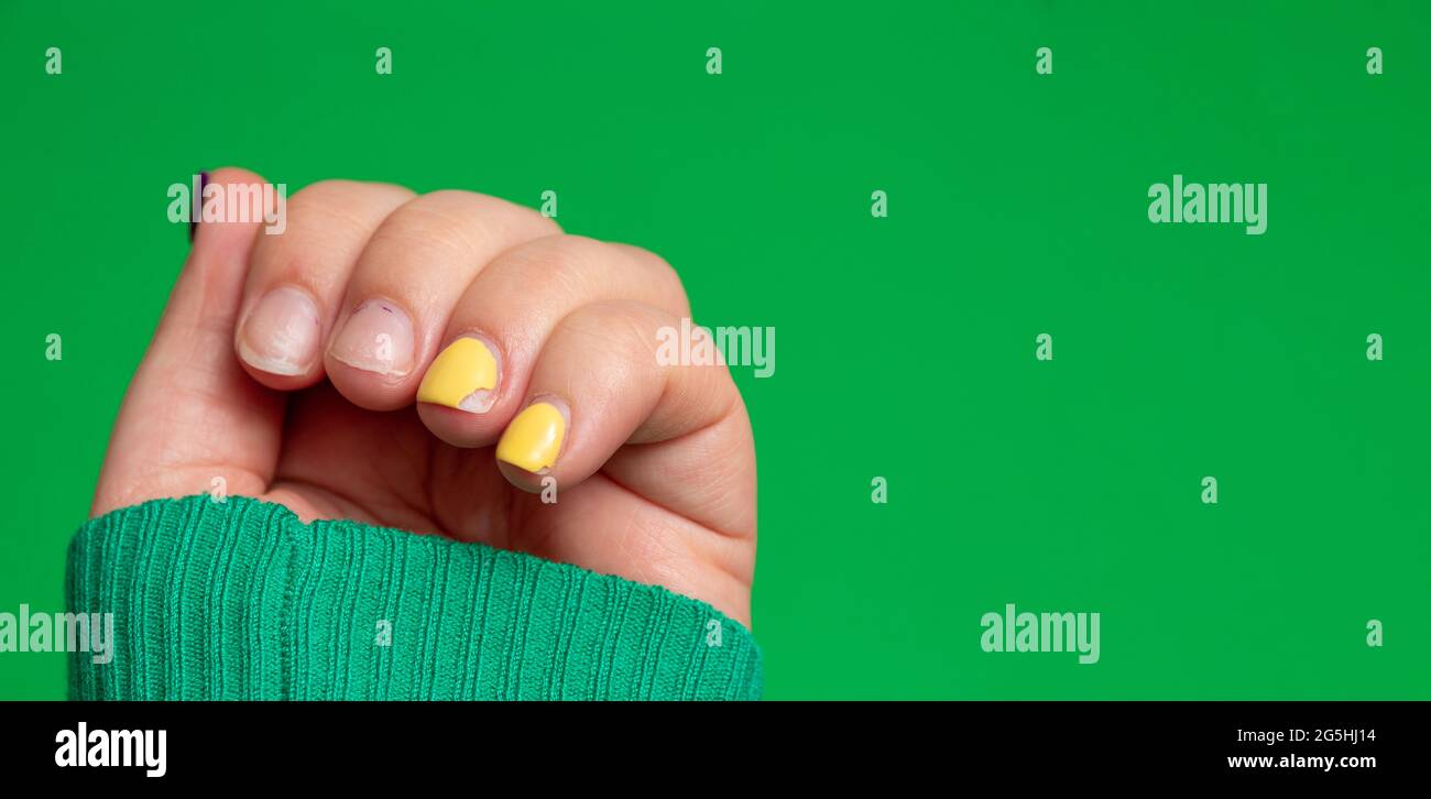 Damaged yellow nail polish on the nails of the hand. Green background with space for text. Selective focus. Stock Photo