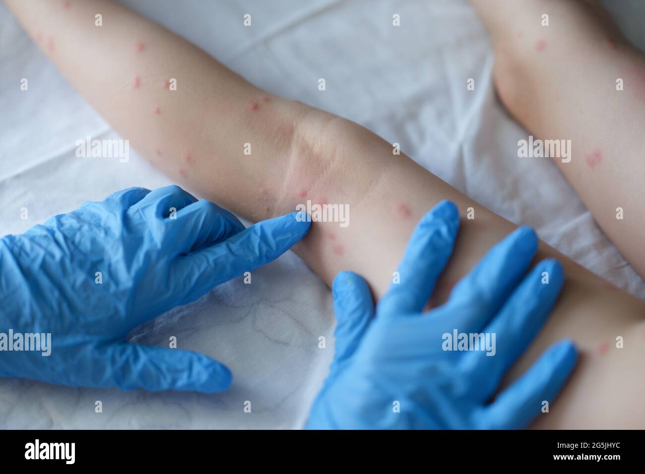 Doctor dermatologist in rubber gloves examining rash on skin of child