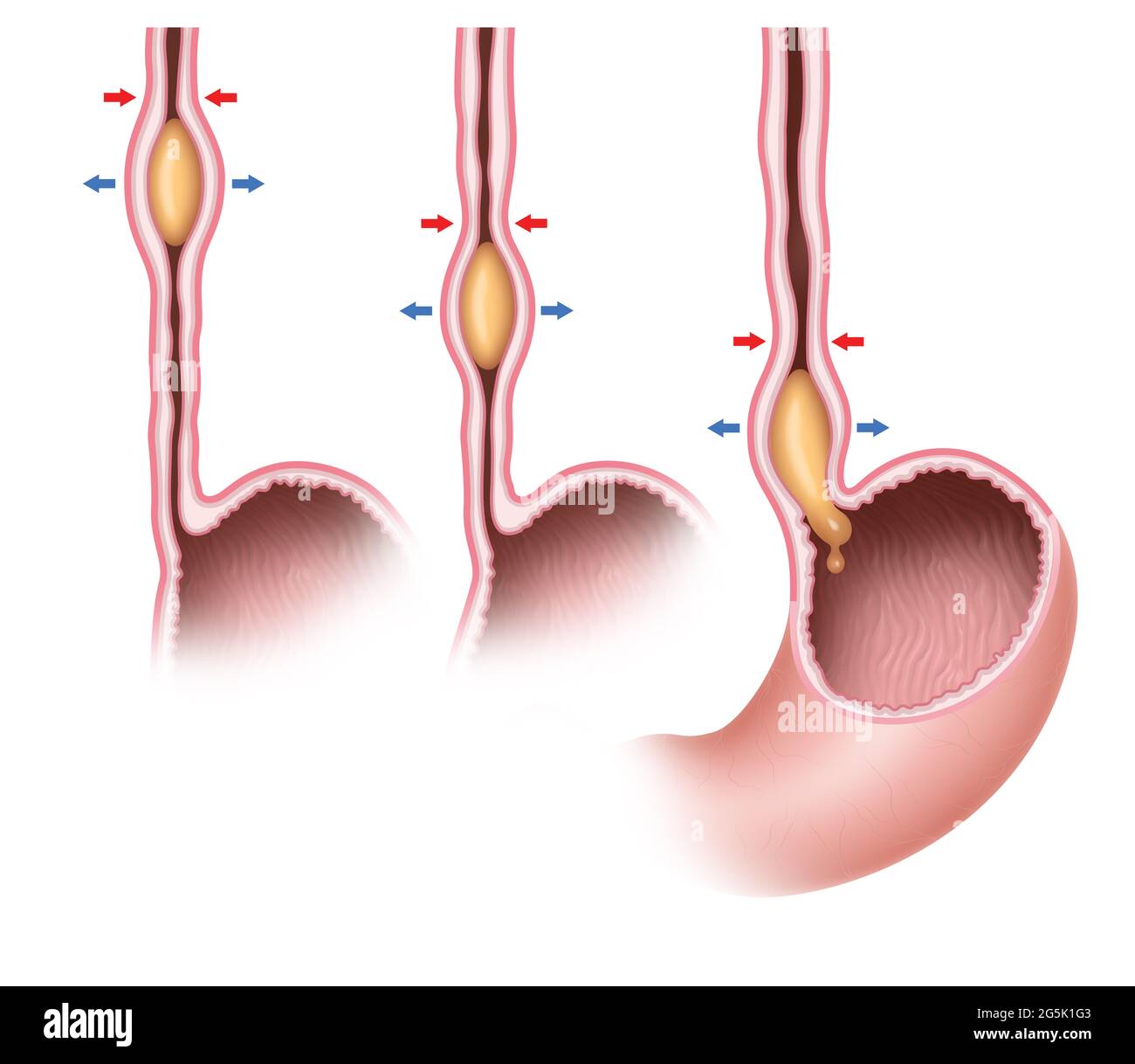 Peristalsis is a radially symmetrical contraction and relaxation of muscles that propagates in a wave down a tube Stock Photo