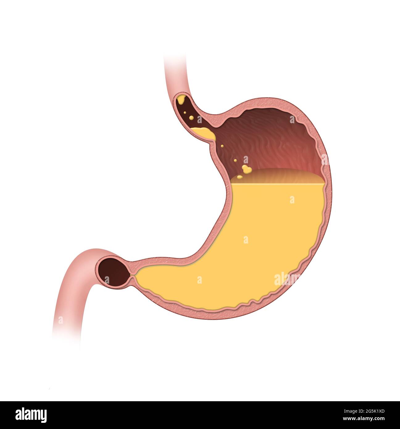 The stomach is a muscular, hollow organ. In the digestive system the