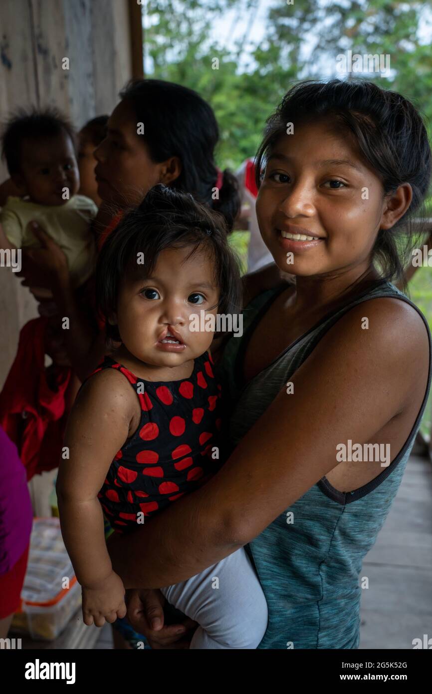 Young Riberenos mother with her baby with a cleft lip in the Peruvian Amazon Stock Photo