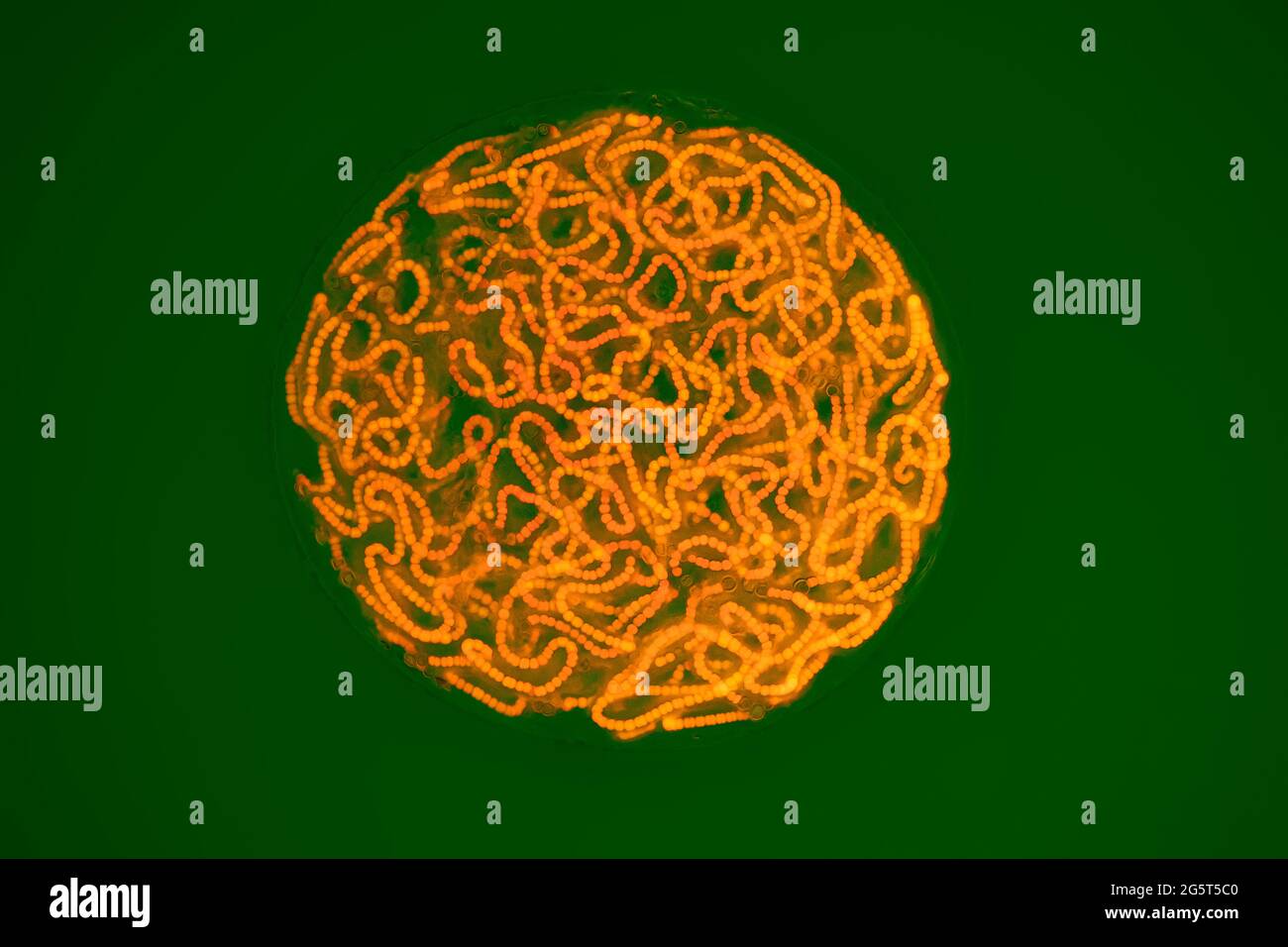 star jelly (Nostoc spec.), MRI image, magnification x160 related to print of 10 cm width, Germany Stock Photo