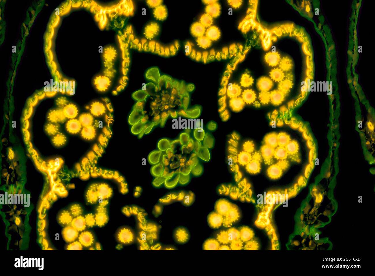 common daisy, lawn daisy, English daisy (Bellis perennis), cross section through a flower head, fluorescence microscope image, magnification x57 Stock Photo