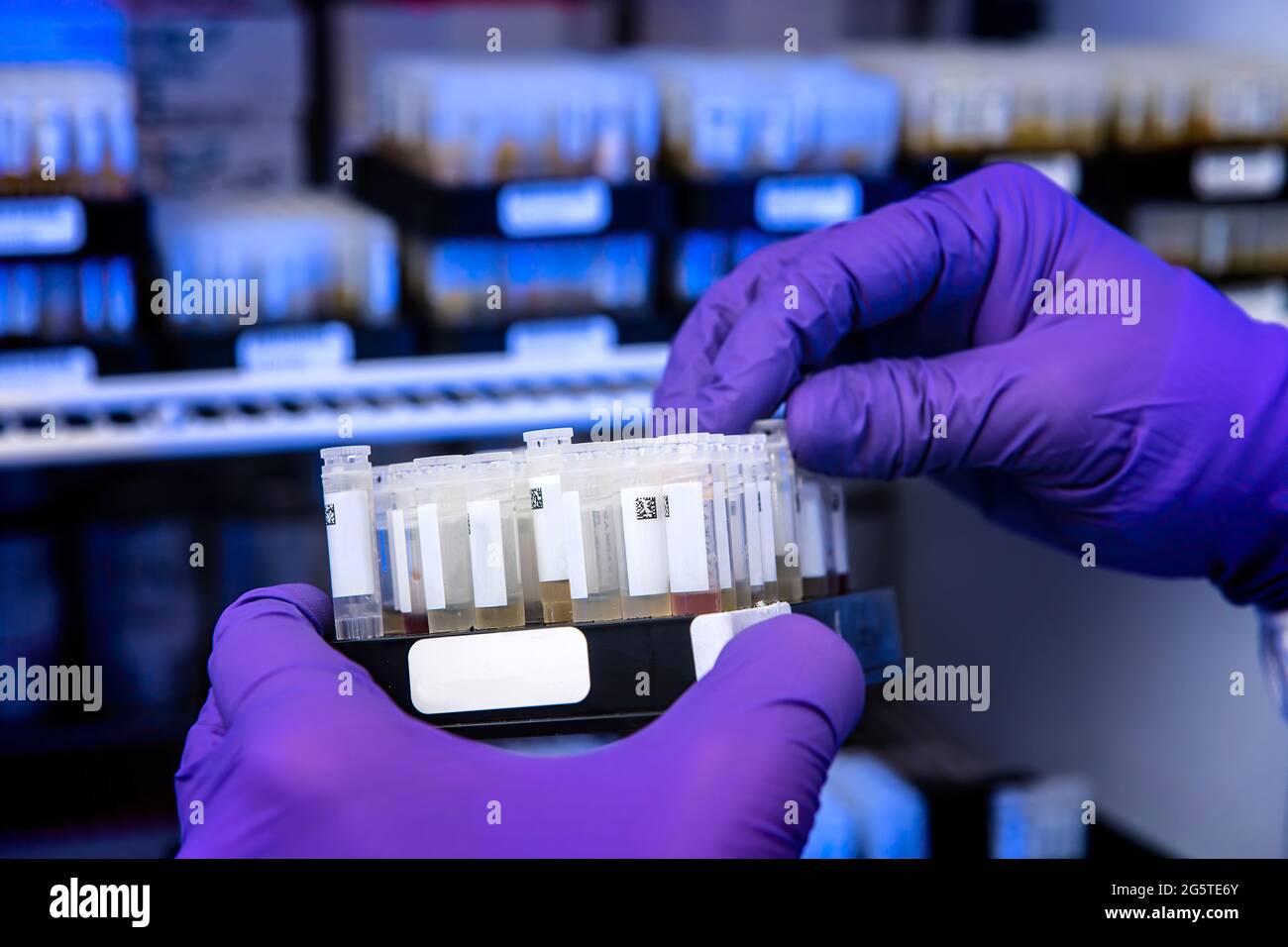Centers for Disease Control and Prevention (CDC) scientists tested serological specimens for antibody,2 antibodies, using automated instrumentation. Serological testing is used to detect antibodies, which indicate past viral infection, and is important to the understand of disease prevalence within a population. Stock Photo
