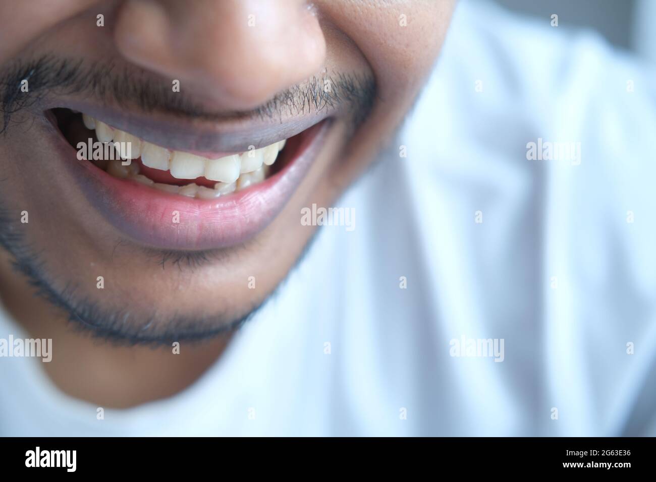 young man open mount checking his teeth  Stock Photo