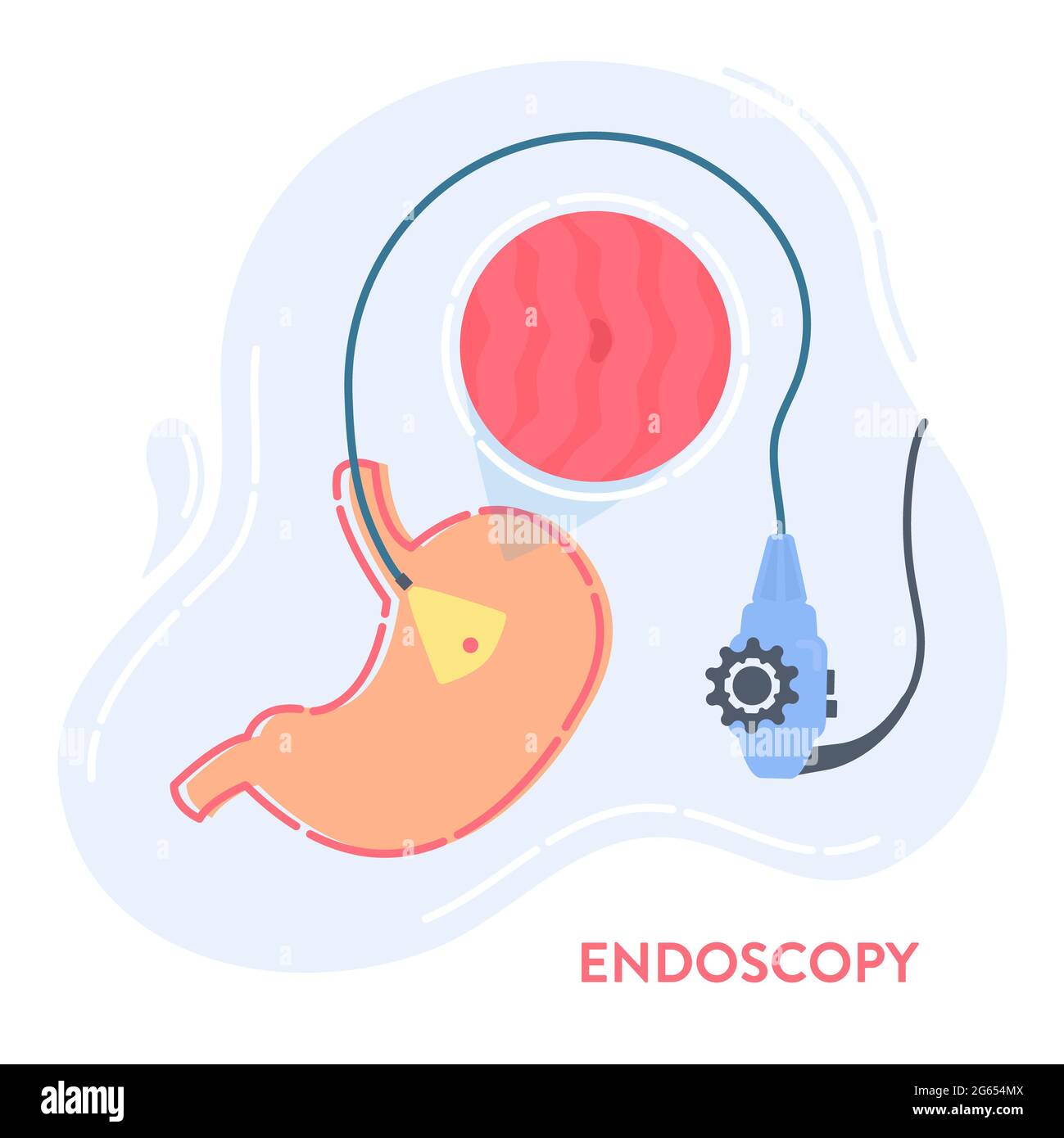 Digestive endoscopy hi-res stock photography and images - Alamy