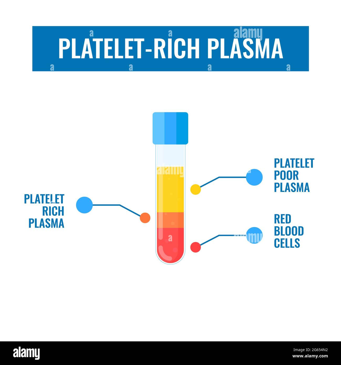 Platelet-rich plasma, illustration Stock Photo
