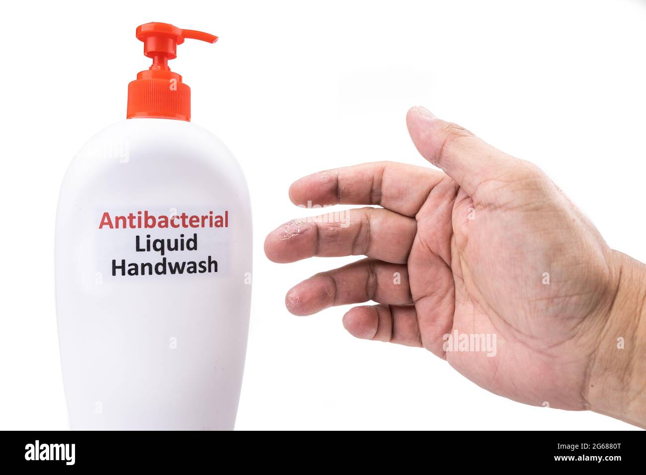 Dry skin on finger with bottle of antibacterial liquid handwash
