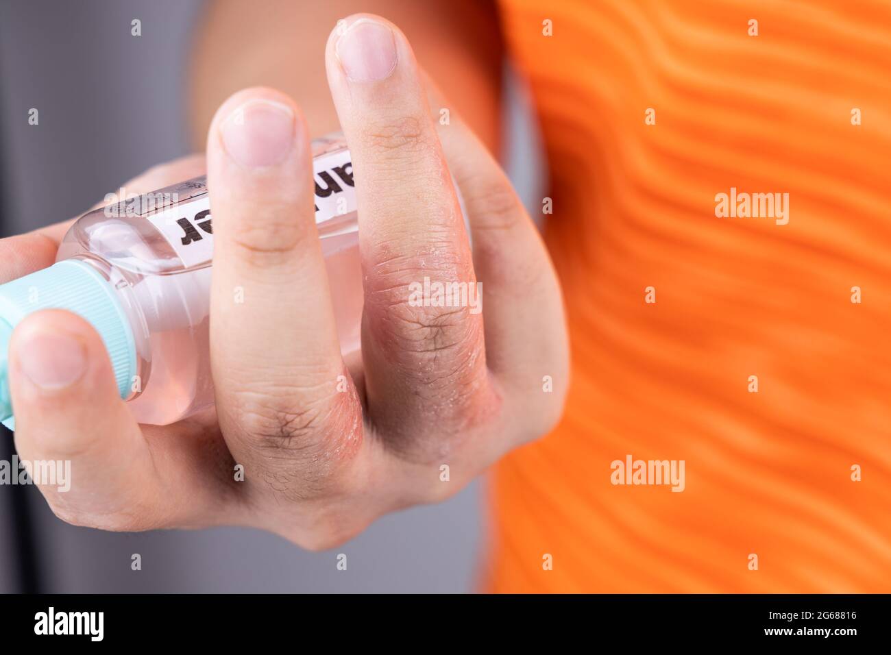 Dry skin finger with bottle of hand sanitizer. Sanitizer causes dryness with frequent use Stock Photo
