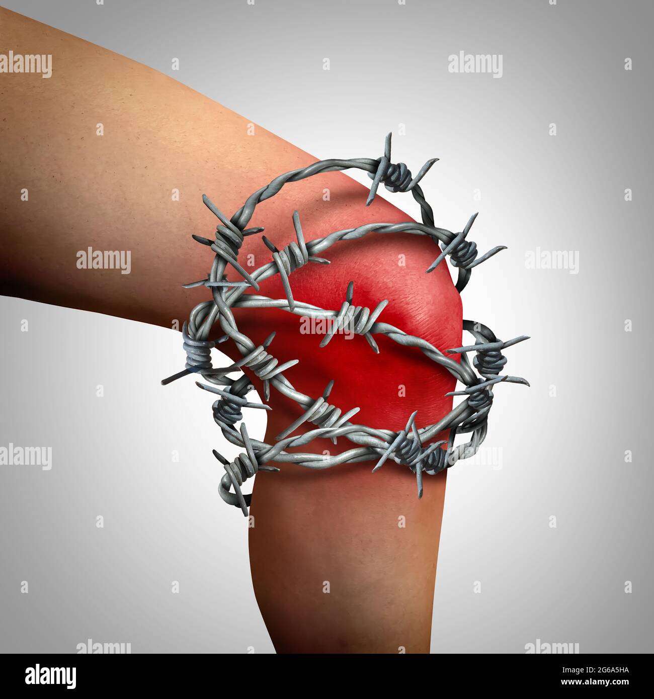 Knee joint pain and leg injury as chronic painful inflammation due to an injury or work accident in a 3D illustration style. Stock Photo