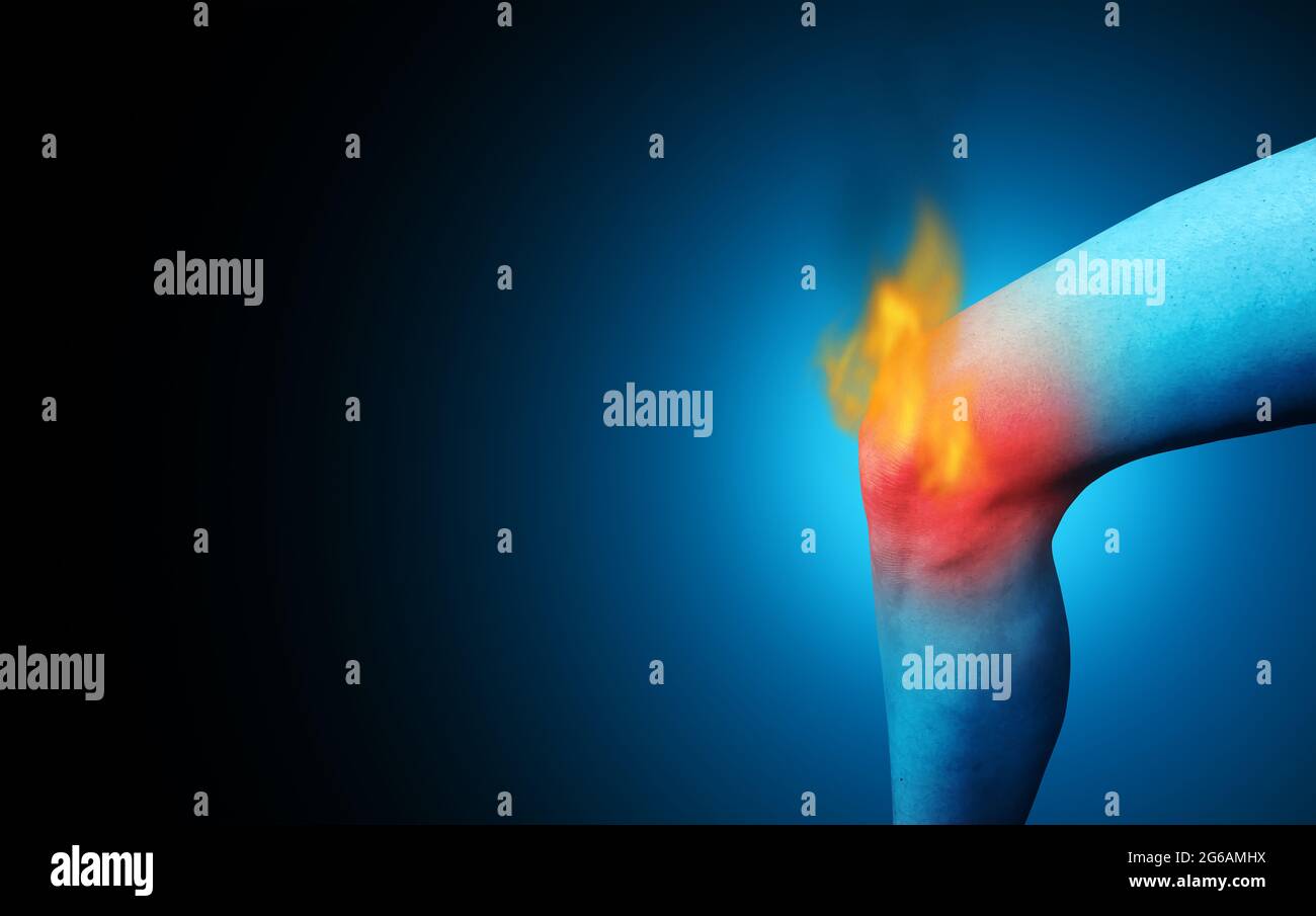 Painful knee joint pain and leg injury as chronic burning pain inflammation due to an injury or work accident. Stock Photo