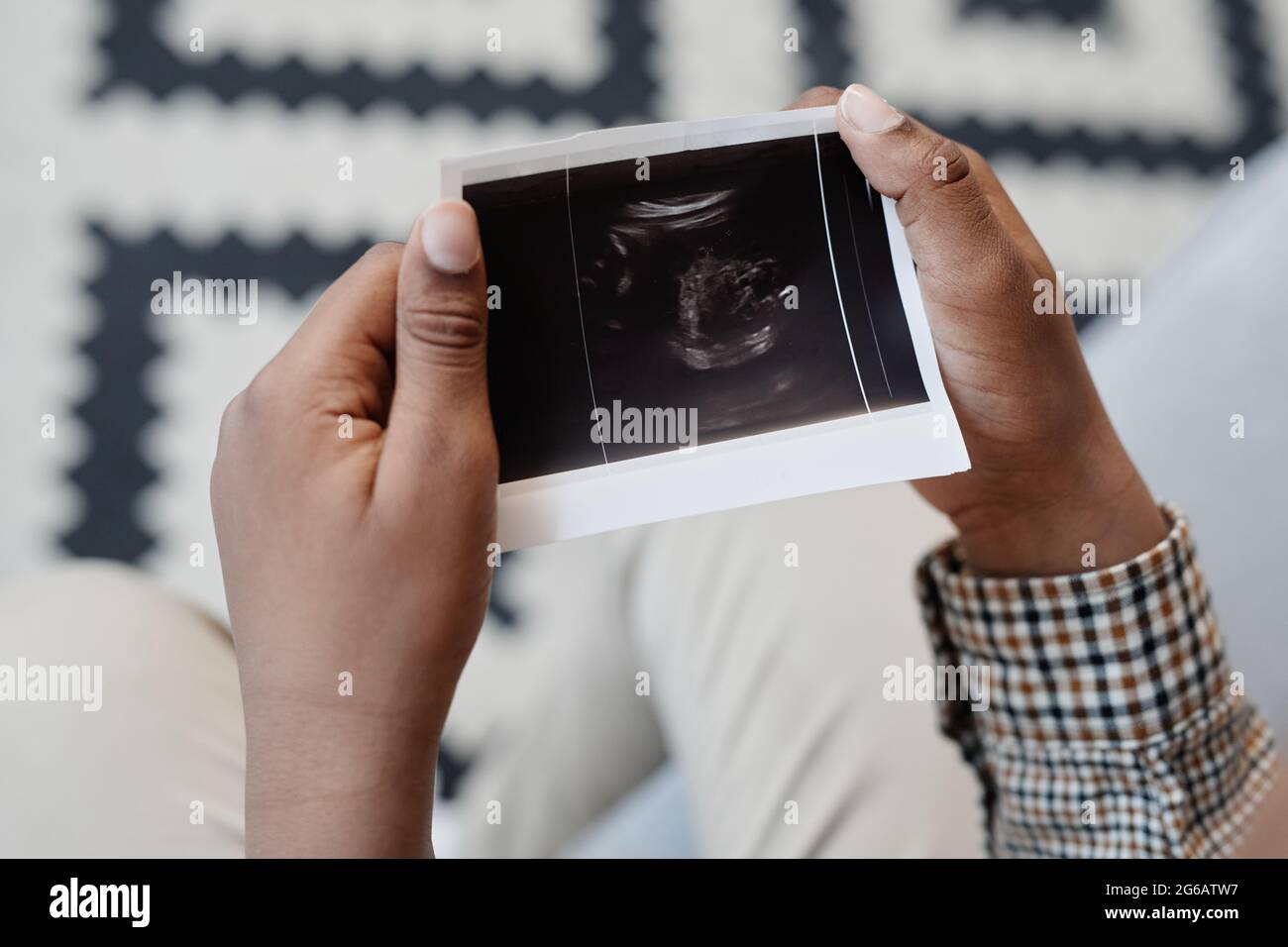 Close up of unrecognizable boy holding baby X ray picture, copy space Stock Photo