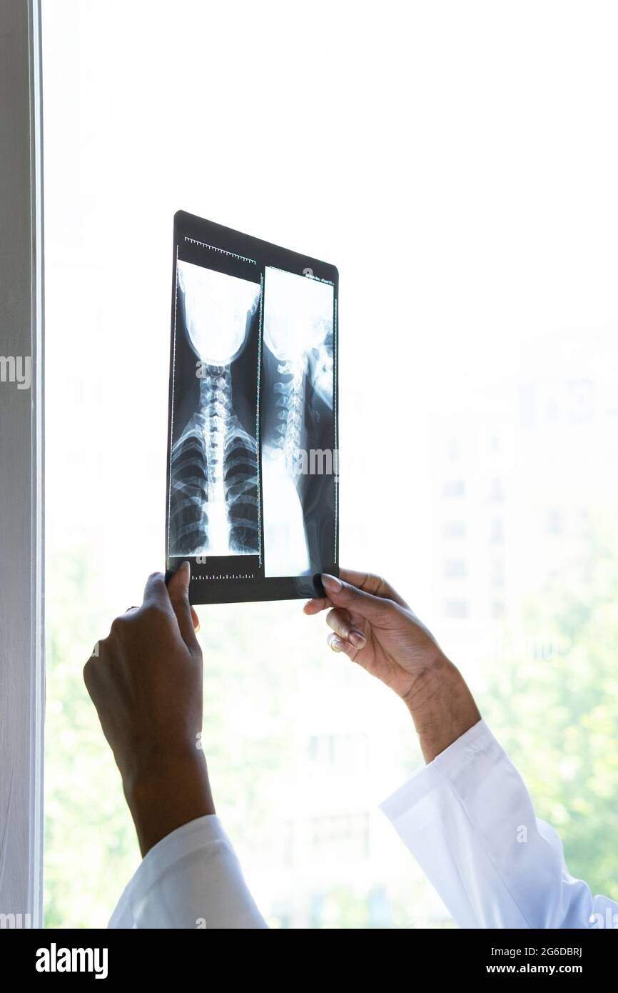 Crop black female medic standing near window and examining x ray scan while working in clinic Stock Photo
