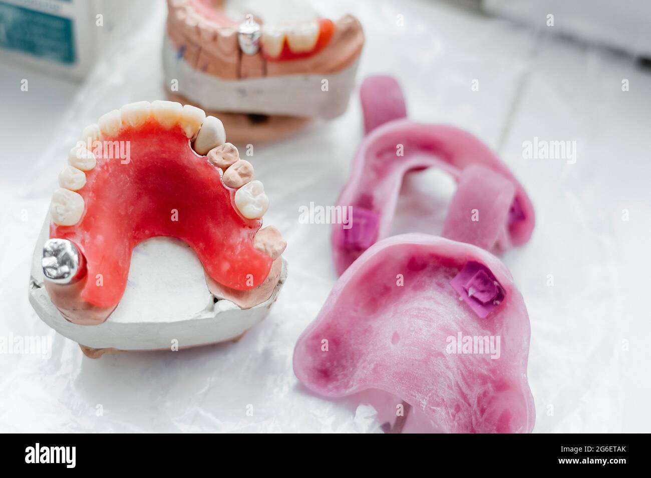 dental gypsum models of upper jaw, dental concept Stock Photo Alamy