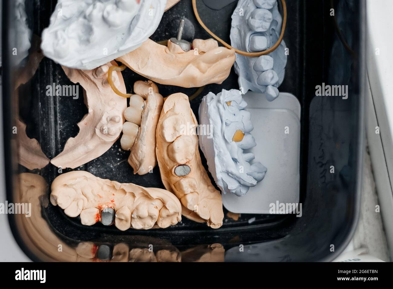 Dental cast plaster model hi-res stock photography and images - Alamy
