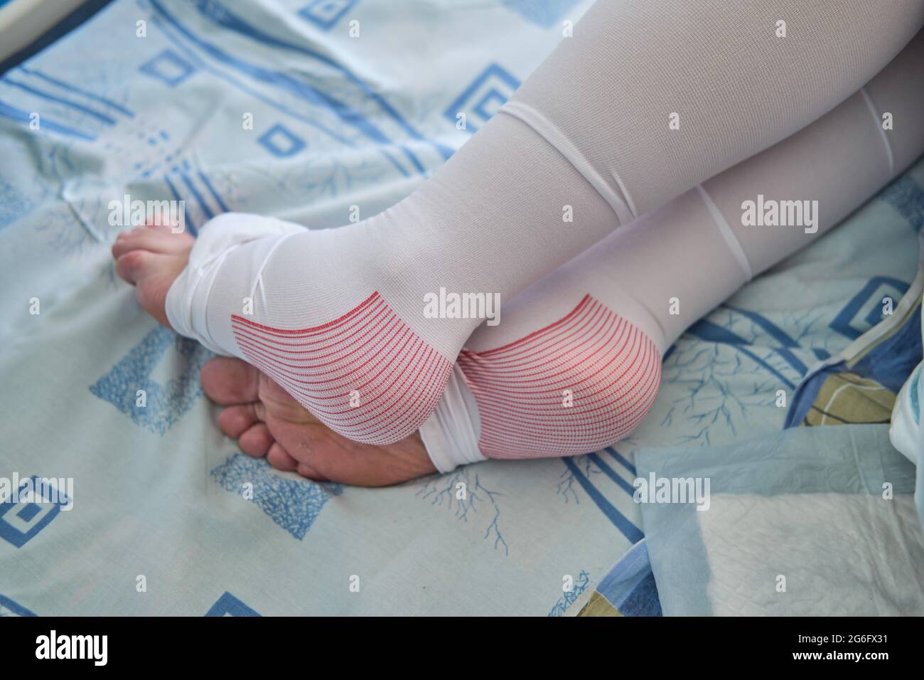 Legs of a pregnant woman in compression stockings on the bed at the