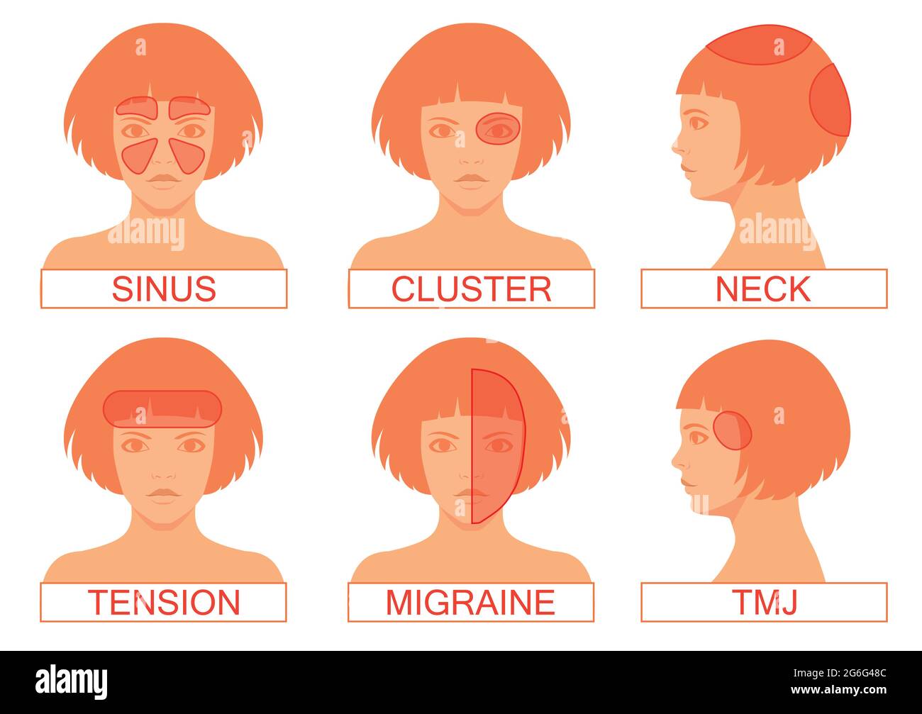 type of headache pain, different head pain illustration Stock Vector