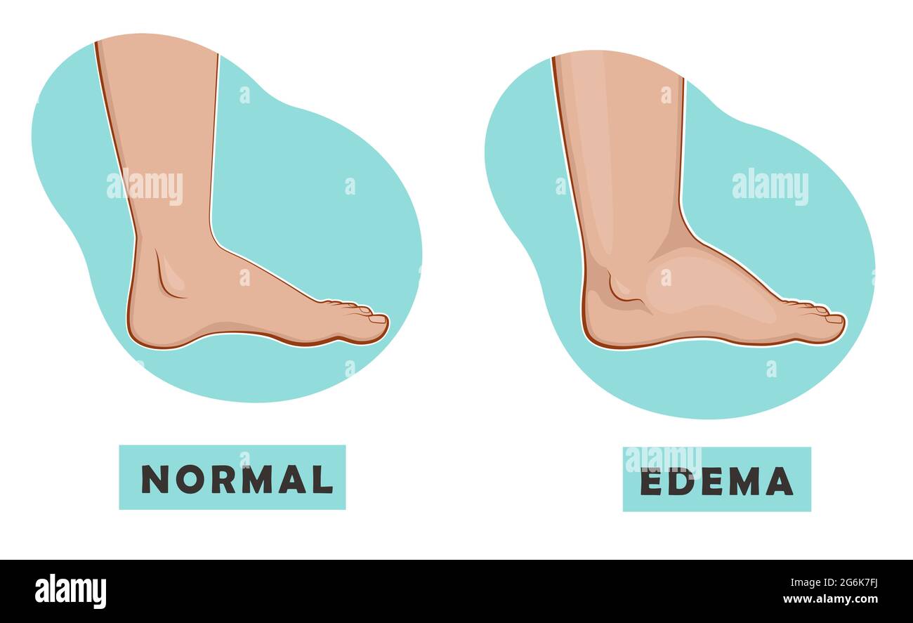 normal foot size