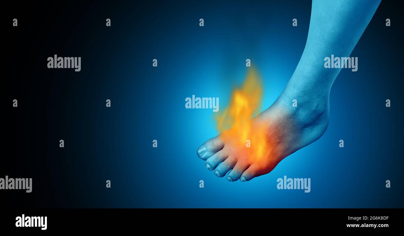 Painful foot and feet pain as a podiatry symbol for painful inflammation. Stock Photo
