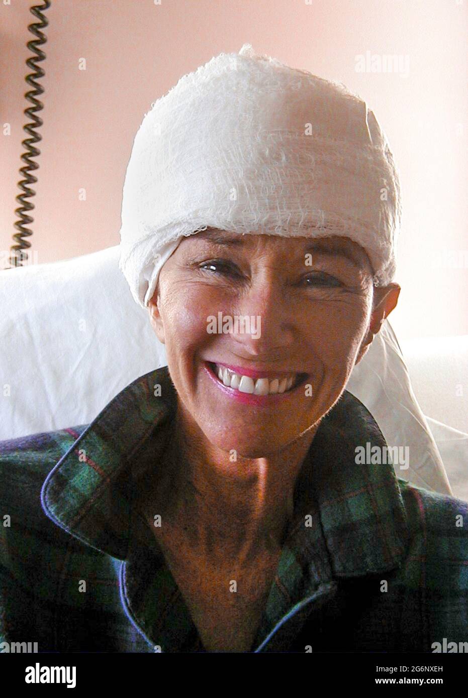 An American woman who suffered from epilepsy offers a happy smile beneath many layers of a gauze wrap that covers a large incision made in her head after an operation on her brain. Her hair was totally removed before the surgeon cut into her scalp and skull (cranium) to perform a temporal lobectomy, a surgery that can lower the number of seizures, make them less severe, or even stop them from happening. During this medical procedure, the doctor removed some of the temporal lobe of her brain where most seizures start. (3rd of 7 related images.) Model released. Stock Photo