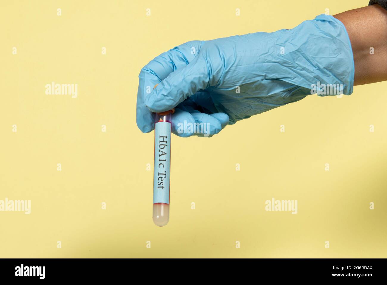 Hba1c hires stock photography and images Alamy