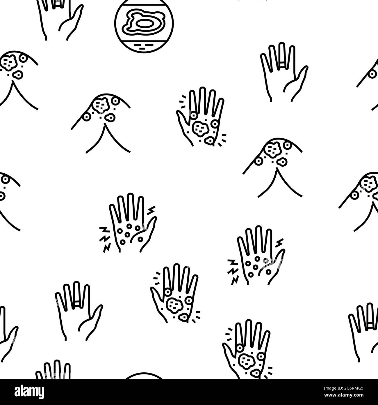 Eczema Disease Treat Vector Seamless Pattern Stock Vector Image & Art ...