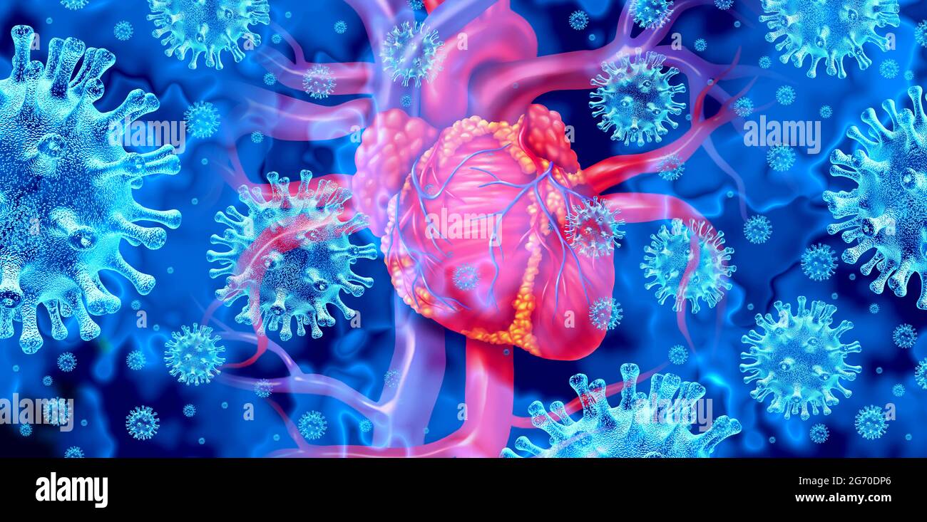 Viral myocarditis or virus infection of the human heart resulting in inflammation  of the cardiac circulatory organ with 3D illustration elements. Stock Photo